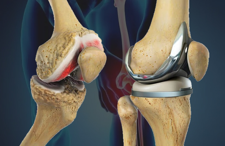 Orthopedic Surgeon in Jayanagar